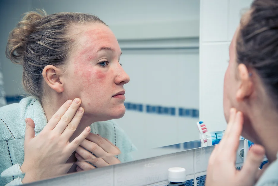 a woman checks her skin allergy in front of the mirror